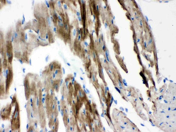 Anti-VDAC/Porin/VDAC1 Antibody