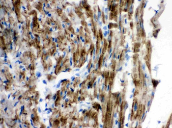 Anti-VDAC/Porin/VDAC1 Antibody