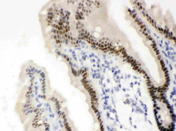 Anti-Vitamin D Receptor/VDR Antibody