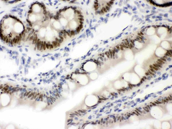 Anti-Vitamin D Receptor/VDR Antibody
