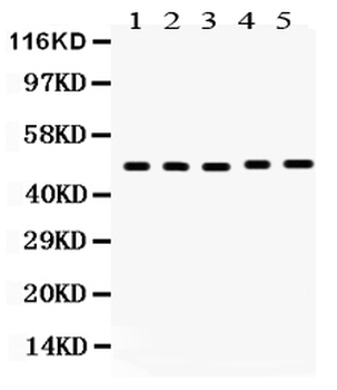 Anti-Vitamin D Receptor/VDR Antibody