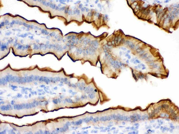 Anti-Villin/VIL1 Antibody