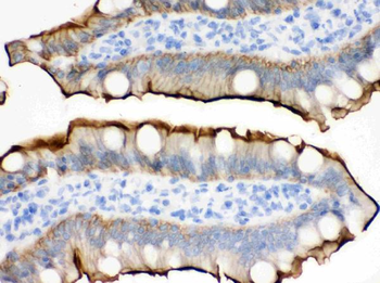 Anti-Villin/VIL1 Antibody