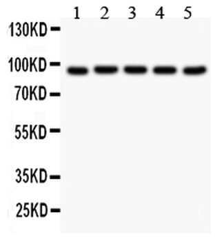 Anti-Villin/VIL1 Antibody