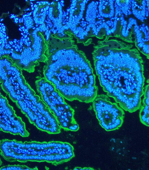 Anti-Villin/VIL1 Antibody