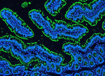 Anti-Villin/VIL1 Antibody