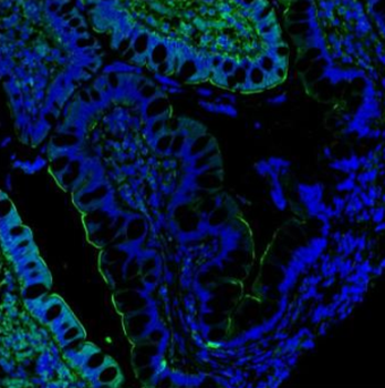 Anti-Villin/VIL1 Antibody