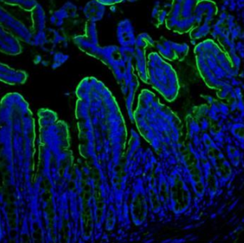 Anti-Villin/VIL1 Antibody