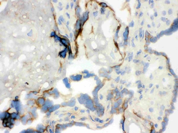 WASP Rabbit Polyclonal Antibody