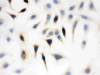 Anti-WASP Antibody