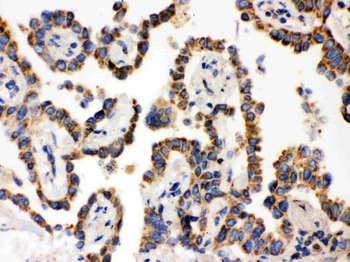 Anti-WASP Antibody