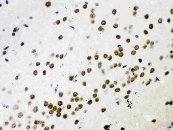 Anti-Wnt2b Antibody