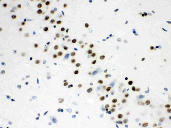 Anti-Wnt2b Antibody