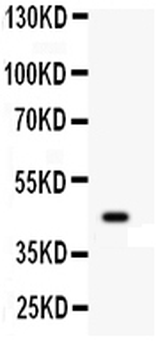Anti-Wnt2b Antibody