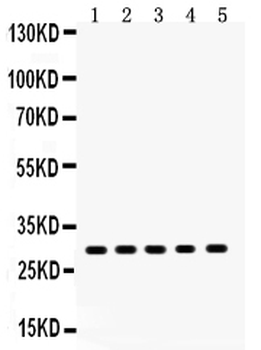 Anti-XBP1 Antibody