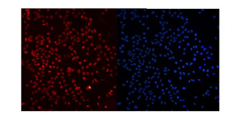 Ku80/XRCC5 Antibody