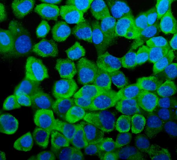 Anti-YB1/YBX1 Antibody
