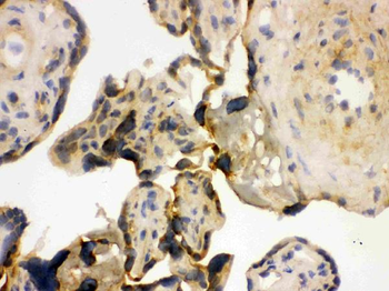 Anti-YB1/YBX1 Antibody