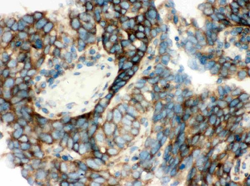 Anti-YB1/YBX1 Antibody