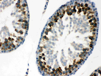Anti-YB1/YBX1 Antibody
