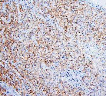 Anti-HSD17B6 Antibody