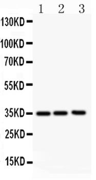 GM-CSF/CSF2 Antibody