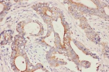 Fatty Acid Binding Protein 5/FABP5 Rabbit Polyclonal Antibody