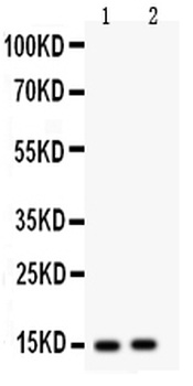 Fatty Acid Binding Protein 5/FABP5 Antibody