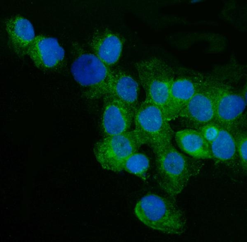 Anti-CD59 glycoprotein CD59 Antibody