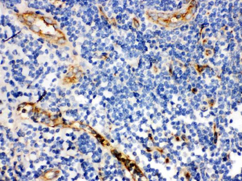 Anti-CD59 glycoprotein CD59 Antibody