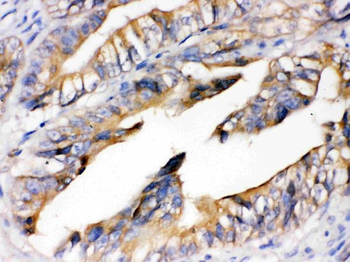 RAGE/AGER Antibody
