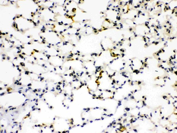 Anti-RAGE/AGER Antibody