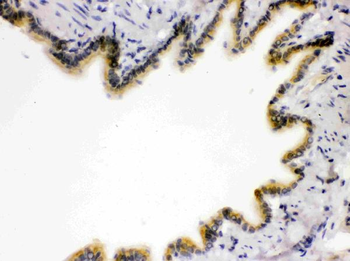 Anti-RAGE/AGER Antibody