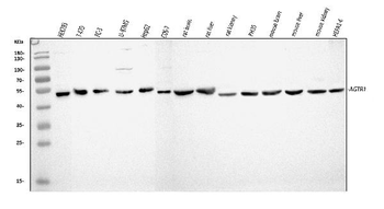 Anti-Angiotensin II Type 1 Receptor/AGTR1 Antibody