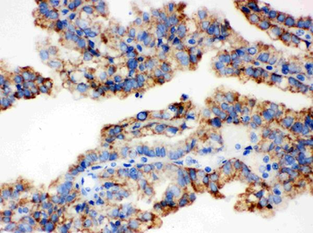 Anti-ALDH2 Antibody