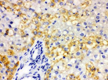 Anti-ALDH2 Antibody