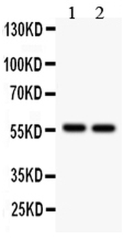 Anti-ALDH2 Antibody