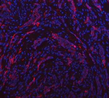 Anti-Aquaporin 1/AQP1 Antibody