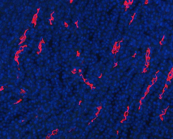Anti-Aquaporin 1/AQP1 Antibody