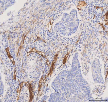 Anti-Aquaporin 1/AQP1 Antibody