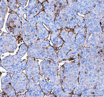 Anti-Aquaporin 1/AQP1 Antibody