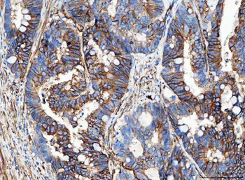 Anti-Aquaporin 1/AQP1 Antibody