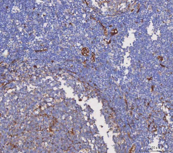 Anti-Aquaporin 1/AQP1 Antibody