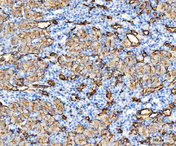 Anti-Aquaporin 1/AQP1 Antibody