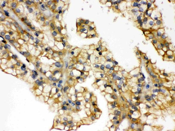 Anti-Aquaporin 2/AQP2 Antibody