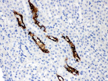 Anti-Aquaporin 2/AQP2 Antibody