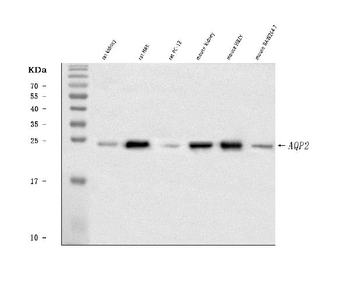 Anti-Aquaporin 2/AQP2 Antibody