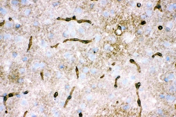 Anti-Aquaporin 4/AQP4 Antibody
