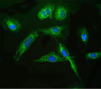 Anti-ARSA Antibody