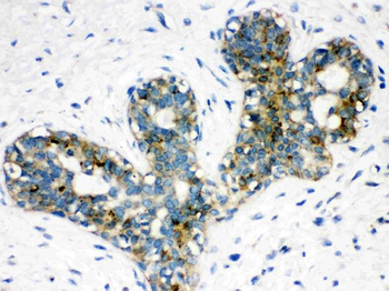 Anti-ARSA Antibody